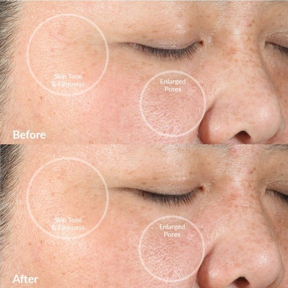 PMD Clean Smart Facial Cleansing Device/Blush-NWT - Picture 5 of 8